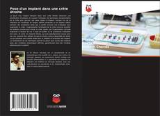 Bookcover of Pose d'un implant dans une crête étroite