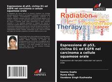 Espressione di p53, ciclina D1 ed EGFR nel carcinoma a cellule squamose orale的封面