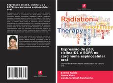 Copertina di Expressão de p53, ciclina-D1 e EGFR no carcinoma espinocelular oral