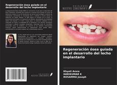 Обложка Regeneración ósea guiada en el desarrollo del lecho implantario