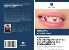Couverture de Gesteuerte Knochenregeneration bei der Entwicklung des Implantatlagers