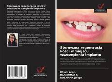 Обложка Sterowana regeneracja kości w miejscu wszczepienia implantu