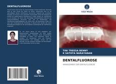 Buchcover von DENTALFLUOROSE