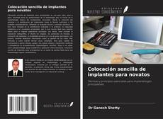 Borítókép a  Colocación sencilla de implantes para novatos - hoz