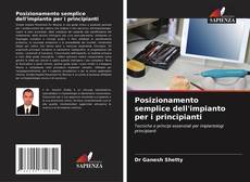 Portada del libro de Posizionamento semplice dell'impianto per i principianti