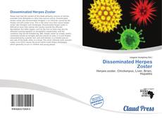 Bookcover of Disseminated Herpes Zoster