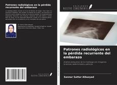 Couverture de Patrones radiológicos en la pérdida recurrente del embarazo