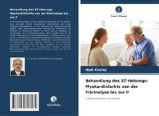 Buchcover von Behandlung des ST-Hebungs-Myokardinfarkts von der Fibrinolyse bis zur P