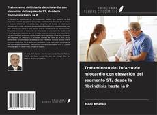Buchcover von Tratamiento del infarto de miocardio con elevación del segmento ST, desde la fibrinólisis hasta la P