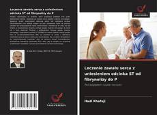 Leczenie zawału serca z uniesieniem odcinka ST od fibrynolizy do P的封面