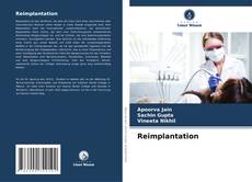 Buchcover von Reimplantation