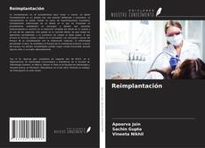 Buchcover von Reimplantación