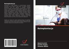 Copertina di Reimplantacja
