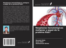 Buchcover von Neoplasias hematológicas malignas y papel de la proteína Rab7