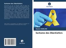 Copertina di Sarkome des Oberkiefers