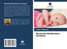 Beckwith-Wiedemann-Syndrom的封面