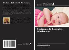 Capa do livro de Síndrome de Beckwith-Wiedemann 