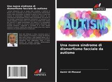 Bookcover of Una nuova sindrome di dismorfismo facciale da autismo