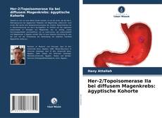 Capa do livro de Her-2/Topoisomerase IIa bei diffusem Magenkrebs: ägyptische Kohorte 