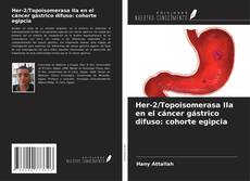 Copertina di Her-2/Topoisomerasa IIa en el cáncer gástrico difuso: cohorte egipcia