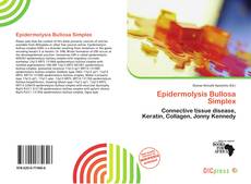 Epidermolysis Bullosa Simplex的封面