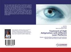 Copertina di Treatment of High Astigmatism with Different Laser Platforms