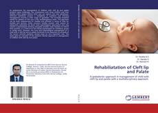 Copertina di Rehabiliatation of Cleft lip and Palate