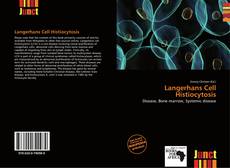 Bookcover of Langerhans Cell Histiocytosis