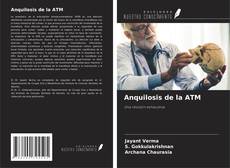 Buchcover von Anquilosis de la ATM