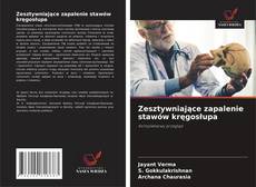 Copertina di Zesztywniające zapalenie stawów kręgosłupa