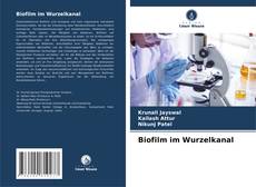 Copertina di Biofilm im Wurzelkanal