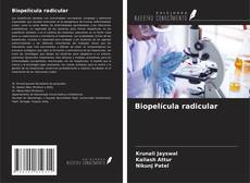 Buchcover von Biopelícula radicular