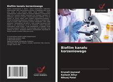 Borítókép a  Biofilm kanału korzeniowego - hoz