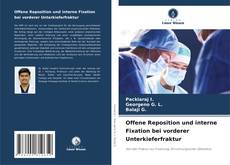 Обложка Offene Reposition und interne Fixation bei vorderer Unterkieferfraktur