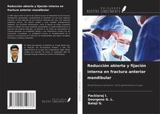 Buchcover von Reducción abierta y fijación interna en fractura anterior mandibular