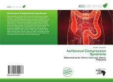 Aortocaval Compression Syndrome的封面