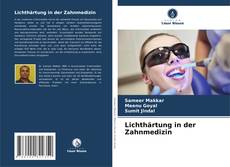 Copertina di Lichthärtung in der Zahnmedizin