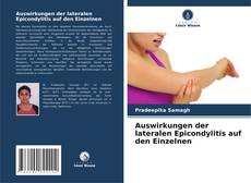 Обложка Auswirkungen der lateralen Epicondylitis auf den Einzelnen