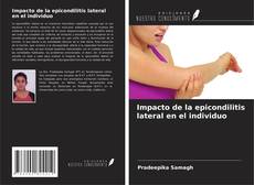 Copertina di Impacto de la epicondilitis lateral en el individuo