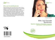 Buchcover von Ellis–van Creveld Syndrome