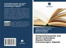 Обложка Sichelzellenanämie und damit verbundene Muskel-Skelett-Erkrankungen, Uganda