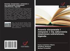 Bookcover of Anemia sierpowata i związane z nią zaburzenia mięśniowo-szkieletowe, Uganda