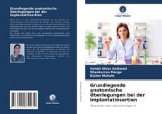 Bookcover of Grundlegende anatomische Überlegungen bei der Implantatinsertion
