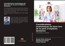 Bookcover of Considérations anatomiques de base lors de la pose d'implants dentaires