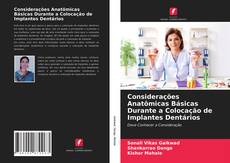 Couverture de Considerações Anatômicas Básicas Durante a Colocação de Implantes Dentários