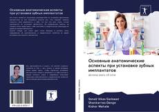 Buchcover von Основные анатомические аспекты при установке зубных имплантатов