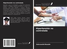 Bookcover of Hipertensión no controlada