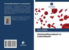 Buchcover von Sichelzellkrankheit in Lubumbashi