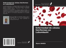 Buchcover von Enfermedad de células falciformes en Lubumbashi