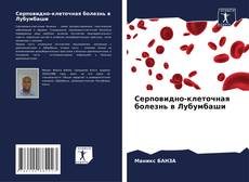 Buchcover von Серповидно-клеточная болезнь в Лубумбаши